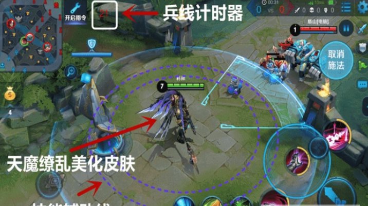 王者荣耀盒子
